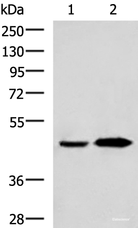 Western blot analysis of Human fetal liver tissue and Human liver tissue lysates using BHMT2 Polyclonal Antibody at dilution of 1:800