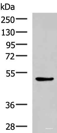 Western blot analysis of LOVO cell lysate using BLNK Polyclonal Antibody at dilution of 1:600