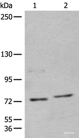 Western blot analysis of 562 and Jurkat cell lysates using NCAPH Polyclonal Antibody at dilution of 1:450