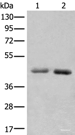 Western blot analysis of A549 and Hela cell lysates using NADK2 Polyclonal Antibody at dilution of 1:1000
