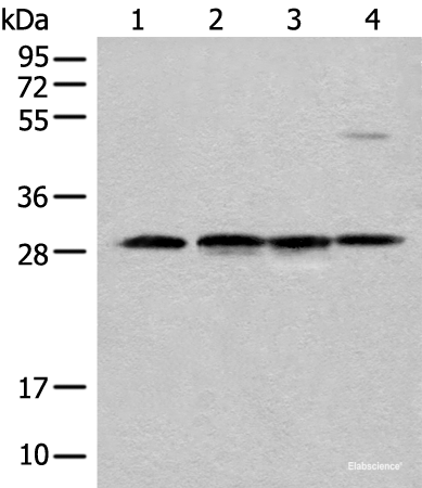 Western blot analysis of Human urinary bladder tissue Mouse heart tissue Mouse kidney tissue and RAW264.7 cell lysates using CA7 Polyclonal Antibody at dilution of 1:500