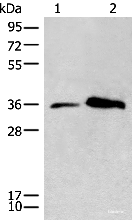 Western blot analysis of Human lymph gland tissue and Jurkat cell lysates using CD86 Polyclonal Antibody at dilution of 1:450