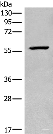 Western blot analysis of Mouse heart tissue lysate using CDADC1 Polyclonal Antibody at dilution of 1:450