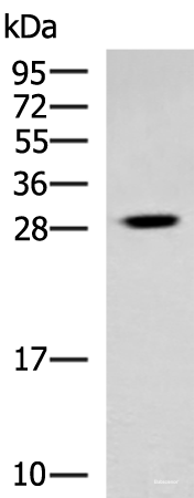 Western blot analysis of Human cerebrum tissue lysate using TBCB Polyclonal Antibody at dilution of 1:800