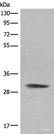 Western blot analysis of Hela cell lysate using COMT Polyclonal Antibody at dilution of 1:450