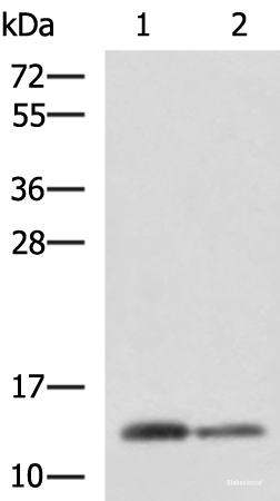 Western blot analysis of Human breast tissue and Human thyroid tissue lysates using CRABP1 Polyclonal Antibody at dilution of 1:2000