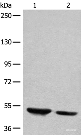 Western blot analysis of Human fetal brain tissue and mouse brain tissue lysates using DENND1B Polyclonal Antibody at dilution of 1:400