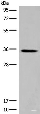 Western blot analysis of Rat kidney tissue lysate using ITM2B Polyclonal Antibody at dilution of 1:500