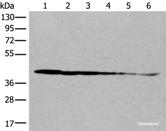 Western blot analysis of Rat brain tissue Human cerebrum tissue Human fetal brain tissue Hela cell Human breast cancer tissue Jurkat cell lysates using PITPNB Polyclonal Antibody at dilution of 1:500