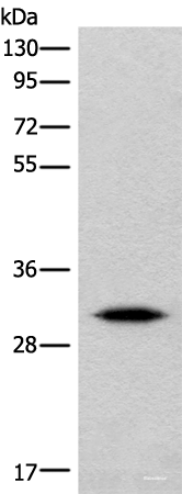 Western blot analysis of Human cerebrum tissue lysate using IMPA1 Polyclonal Antibody at dilution of 1:360
