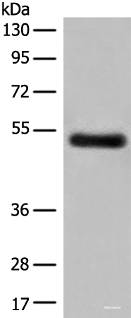 Western blot analysis of Human breast cancer tissue lysate using GK5 Polyclonal Antibody at dilution of 1:500