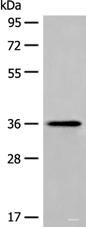Western blot analysis of Human liver tissue lysate using MLST8 Polyclonal Antibody at dilution of 1:400