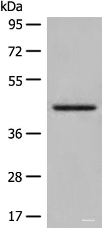 Western blot analysis of Human kidney tissue lysate using DHRS7 Polyclonal Antibody at dilution of 1:400