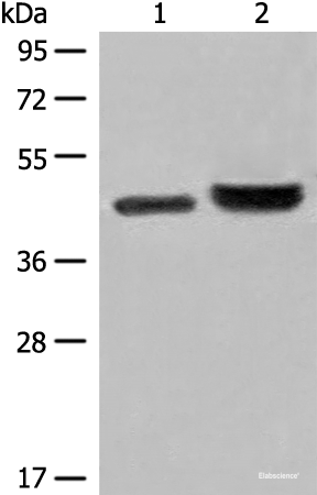 Western blot analysis of 231 cell and Human fetal liver tissue lysates using INPP1 Polyclonal Antibody at dilution of 1:500