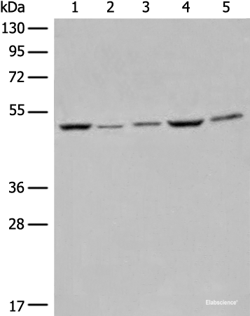 Western blot analysis of Raji Hela A549 HEPG2 and 231 cell lysates using EIF4A3 Polyclonal Antibody at dilution of 1:500