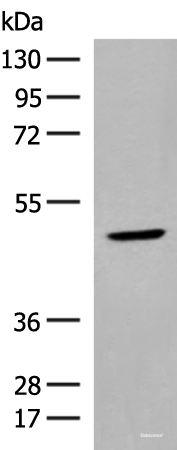 Western blot analysis of Human thyroid tissue lysate using ZBTB8A Polyclonal Antibody at dilution of 1:350