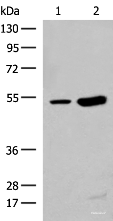 Western blot analysis of Human left thymus tissue and Mouse kidney tissue lysates using ZBTB43 Polyclonal Antibody at dilution of 1:250