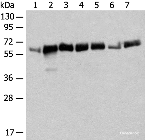Western blot analysis of Mouse heart tissue Mouse liver tissue NIH/3T3 cell Human bladder transitional cell carcinoma grade 2-3 tissue A172 cell Human placenta tissue K562 cell lysates using CCDC47 Polyclonal Antibody at dilution of 1:350