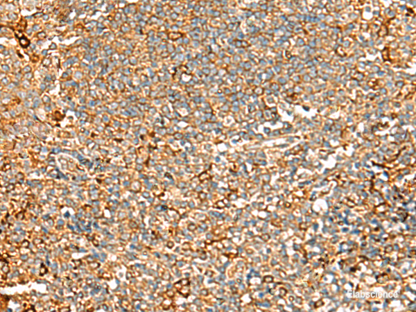 Immunohistochemistry of paraffin-embedded Human tonsil tissue using ASMTL Polyclonal Antibody at dilution of 1:100(×200)