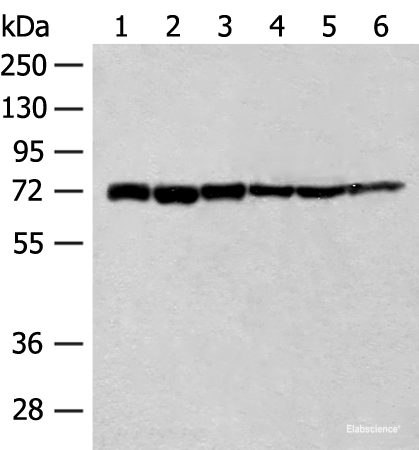 Western blot analysis of 293T cell Human fetal brain tissue Jurkat cell Hela cell Mouse heart tissue lysates using TCF25 Polyclonal Antibody at dilution of 1:250
