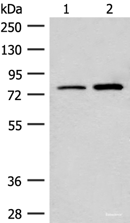 Western blot analysis of Human cerebrum tissue and Human fetal brain tissue lysates using THOP1 Polyclonal Antibody at dilution of 1:250
