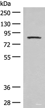 Western blot analysis of Mouse brain tissue lysate using PFKM Polyclonal Antibody at dilution of 1:350