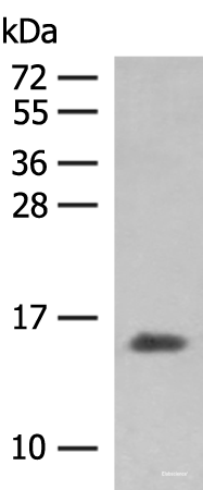 Western blot analysis of Human plasma solution using HBG1:HBG2 Polyclonal Antibody at dilution of 1:250