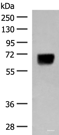 Western blot analysis of Human thyroid tissue lysate using DGLUCY Polyclonal Antibody at dilution of 1:250