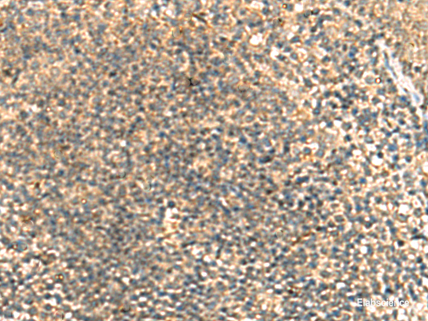Immunohistochemistry of paraffin-embedded Human tonsil tissue using TCAP Polyclonal Antibody at dilution of 1:55(×200)