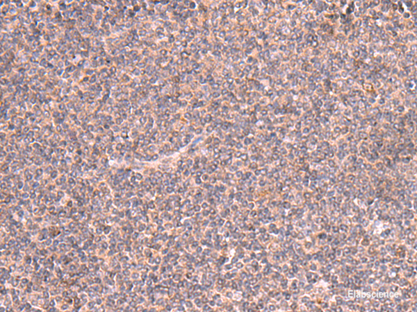 Immunohistochemistry of paraffin-embedded Human tonsil tissue using MRPS24 Polyclonal Antibody at dilution of 1:90(×200)