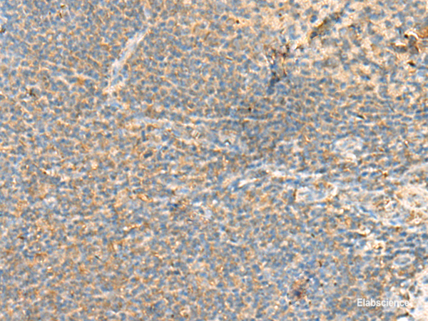 Immunohistochemistry of paraffin-embedded Human tonsil tissue using RHOH Polyclonal Antibody at dilution of 1:90(×200)