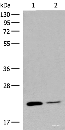 Western blot analysis of Human empty ileal tissue and Human ileum tissue lysates using RAC3 Polyclonal Antibody at dilution of 1:400