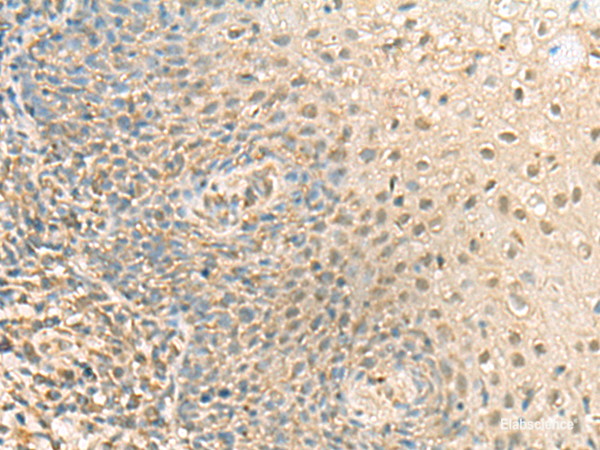 Immunohistochemistry of paraffin-embedded Human tonsil tissue using PPCDC Polyclonal Antibody at dilution of 1:55(×200)