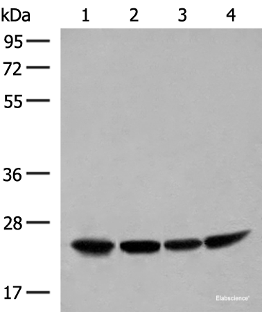 Western blot analysis of Human fetal liver tissue HepG2 K562 and Raji cell lysates using DTYMK Polyclonal Antibody at dilution of 1:400