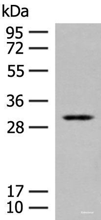 Western blot analysis of Human kidney tissue lysate using TPMT Polyclonal Antibody at dilution of 1:400