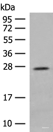 Western blot analysis of Human placenta tissue lysate using MDFI Polyclonal Antibody at dilution of 1:400