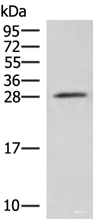 Western blot analysis of Mouse brain tissue lysate using NIPSNAP3A Polyclonal Antibody at dilution of 1:550