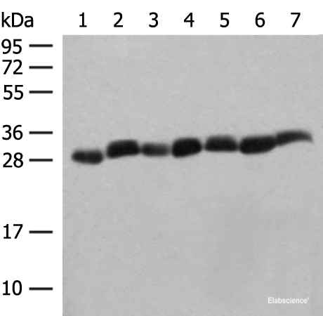 Western blot analysis of Hela cell Mouse spleen tissue Mouse liver tissue PC3 cell HL60 cell A549 cell NIH/3T3 cell lysates using PSMA3 Polyclonal Antibody at dilution of 1:350