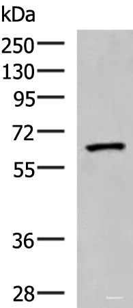Western blot analysis of Human placenta tissue lysate using PDIA5 Polyclonal Antibody at dilution of 1:1000