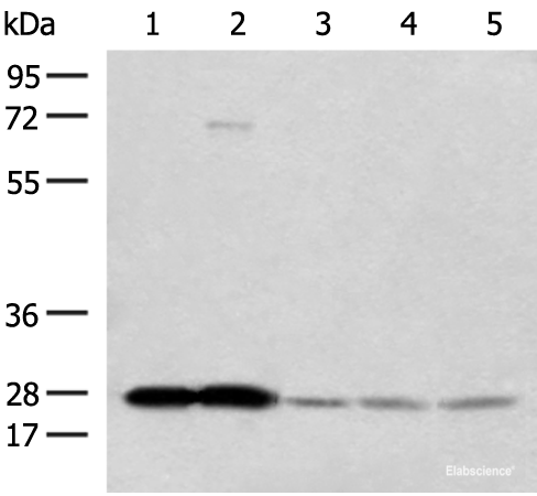 Western blot analysis of Human cerebella tissue Human cerebrum tissue Human skin tissue NIH/3T3 cell SKOV3 cell lysates using OVOL2 Polyclonal Antibody at dilution of 1:350