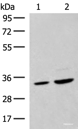Western blot analysis of Hela cell and Human fetal liver tissue lysates using SCGN Polyclonal Antibody at dilution of 1:600