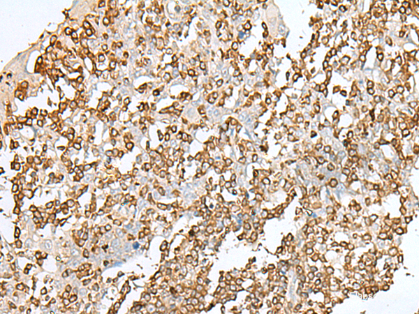 Immunohistochemistry of paraffin-embedded Human tonsil tissue using SEPT1 Polyclonal Antibody at dilution of 1:50(×200)