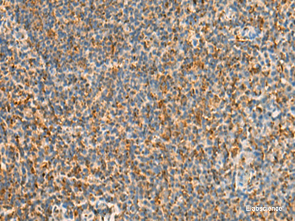 Immunohistochemistry of paraffin-embedded Human tonsil tissue using STK32C Polyclonal Antibody at dilution of 1:40(×200)