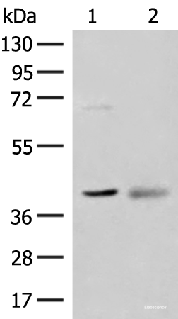 Western blot analysis of Mouse kidney tissue and Human fetal brain tissue lysates using ADH5 Polyclonal Antibody at dilution of 1:500
