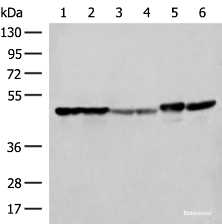 Western blot analysis of Hela A375 Human fetal liver tissue Human fetal brain tissue HepG2 cell and Mouse brain tissue lysates using FLOT2 Polyclonal Antibody at dilution of 1:350