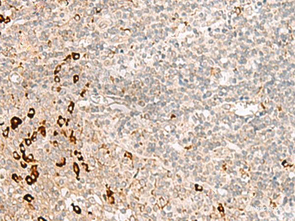 Immunohistochemistry of paraffin-embedded Human tonsil tissue using RMND5A Polyclonal Antibody at dilution of 1:50(×200)