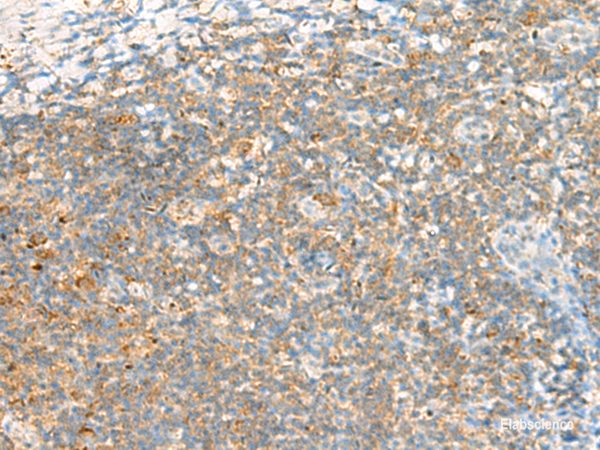 Immunohistochemistry of paraffin-embedded Human tonsil tissue using TTLL1 Polyclonal Antibody at dilution of 1:60(×200)