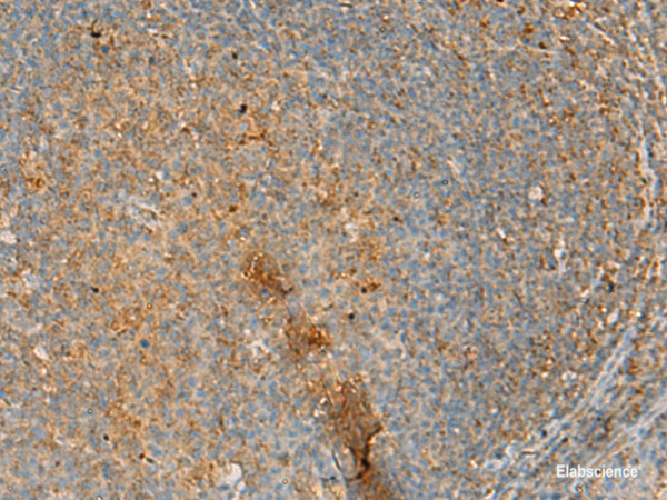 Immunohistochemistry of paraffin-embedded Human tonsil tissue using ERAL1 Polyclonal Antibody at dilution of 1:50(×200)