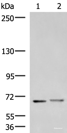 Western blot analysis of Mouse brain tissue and Human cerebrum tissue lysates using EXD2 Polyclonal Antibody at dilution of 1:700