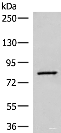 Western blot analysis of Human hepatocellular carcinoma tissue lysate using SLC26A3 Polyclonal Antibody at dilution of 1:250